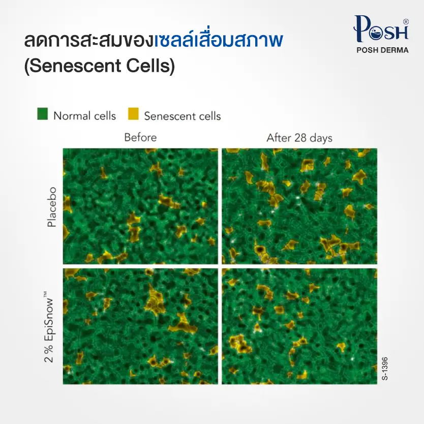 EpiSnow ลดการสะสมของเซลล์เสื่อมสภาพ (Senescent Cells)