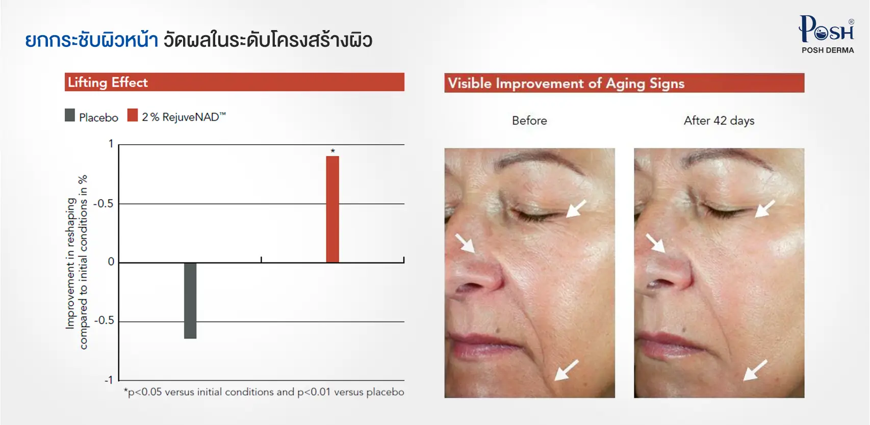RejuveNAD ยกกระชับผิวหน้า วัดผลในระดับโครงสร้างผิว