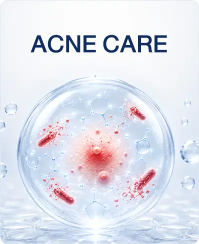 โรงงาน OEM รับผลิต  ครีมรักษาสิว Acne Care